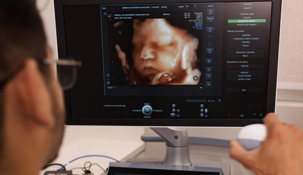 Ultrassonografia ginecológica